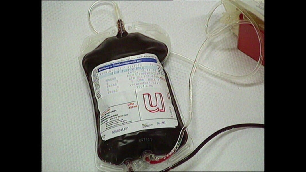 AIDS Funding Freeze: Impact of Trump Aid Halt on Global Health Efforts