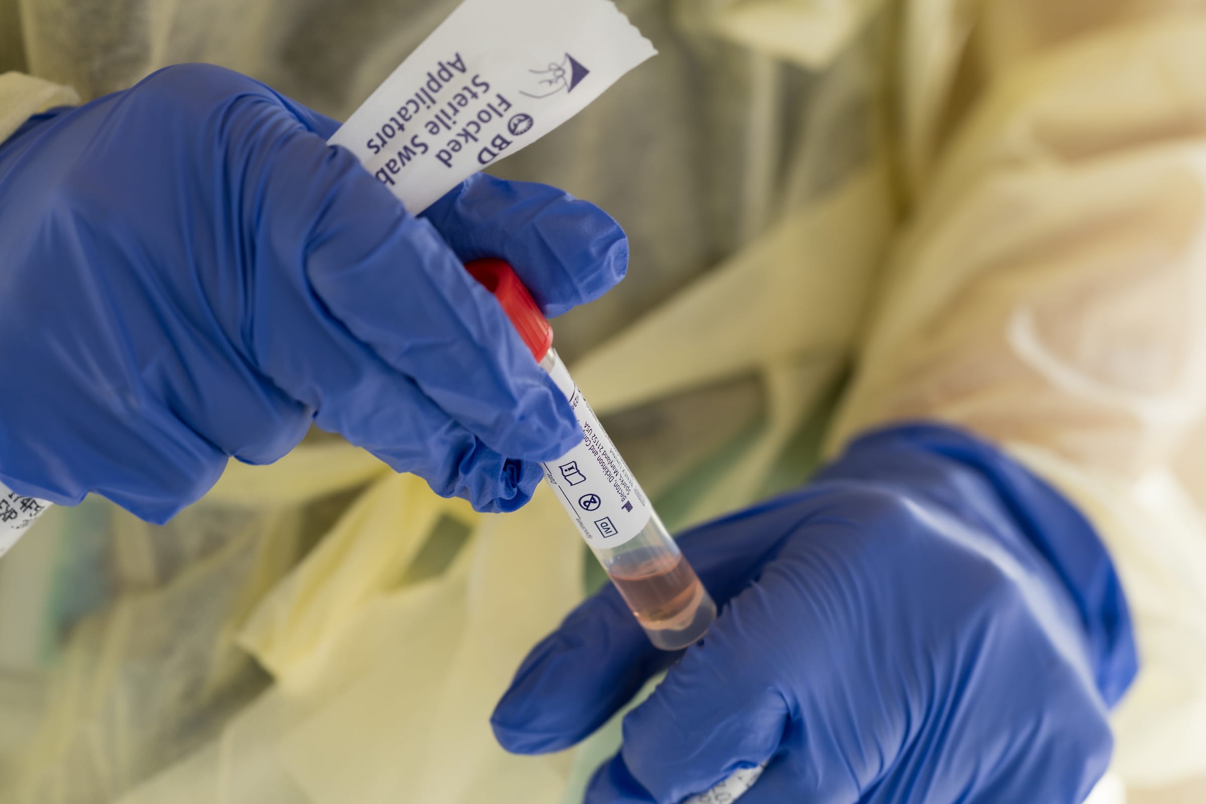 Five Years of COVID-19: What We Know and What Remains Uncertain