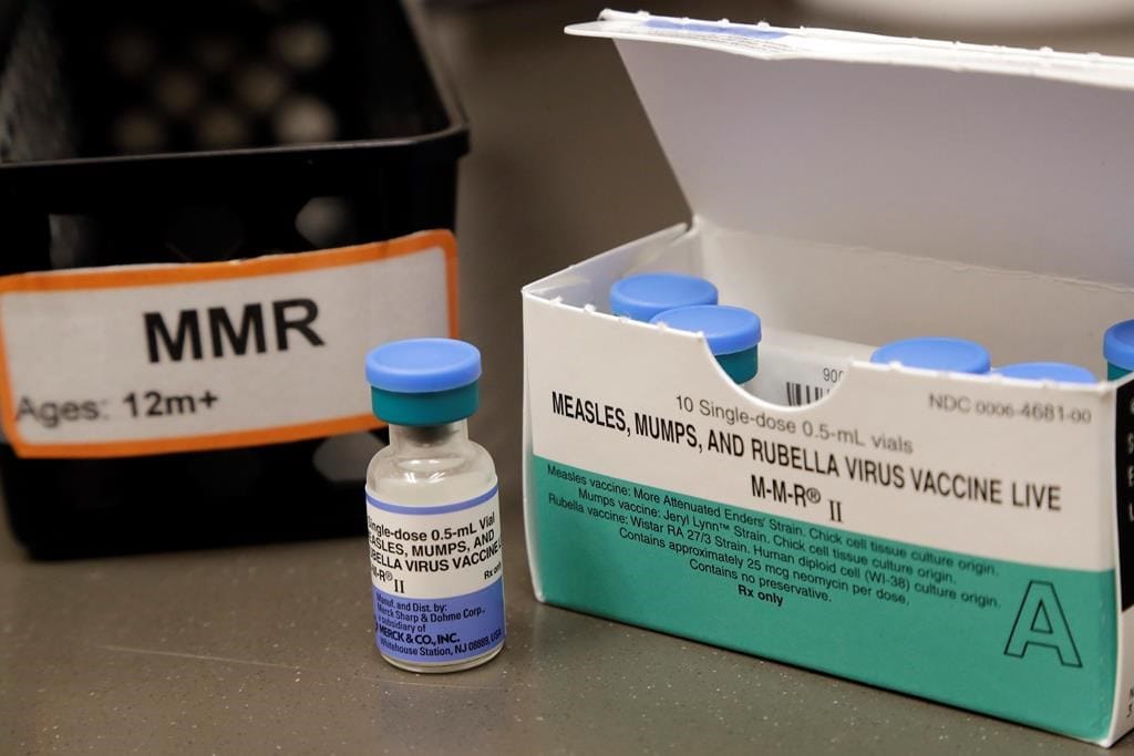 Measles Outbreak: Over 800 Cases Reported Across the U.S.
